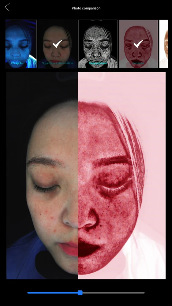 VIEW SKIN